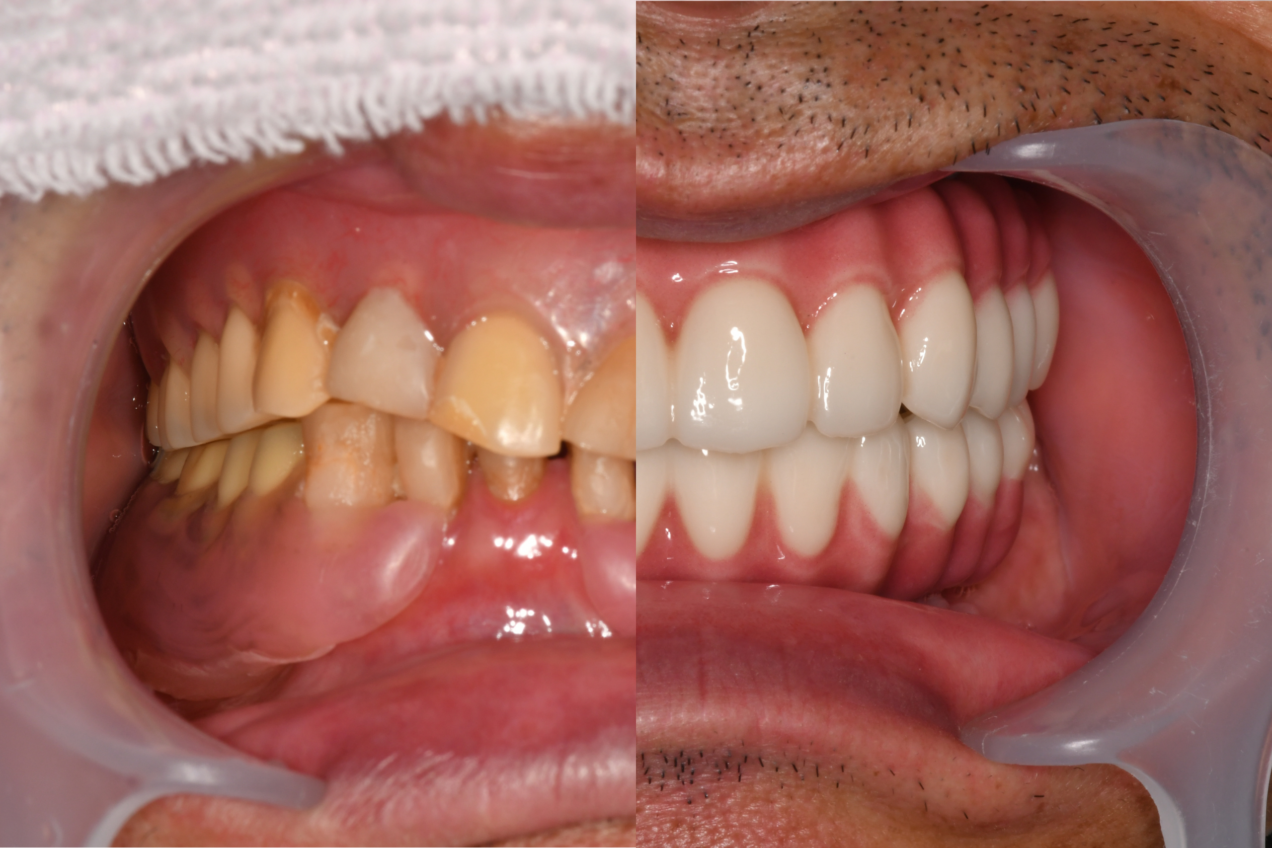 オールオン4ザイゴマ：岡本和矢様