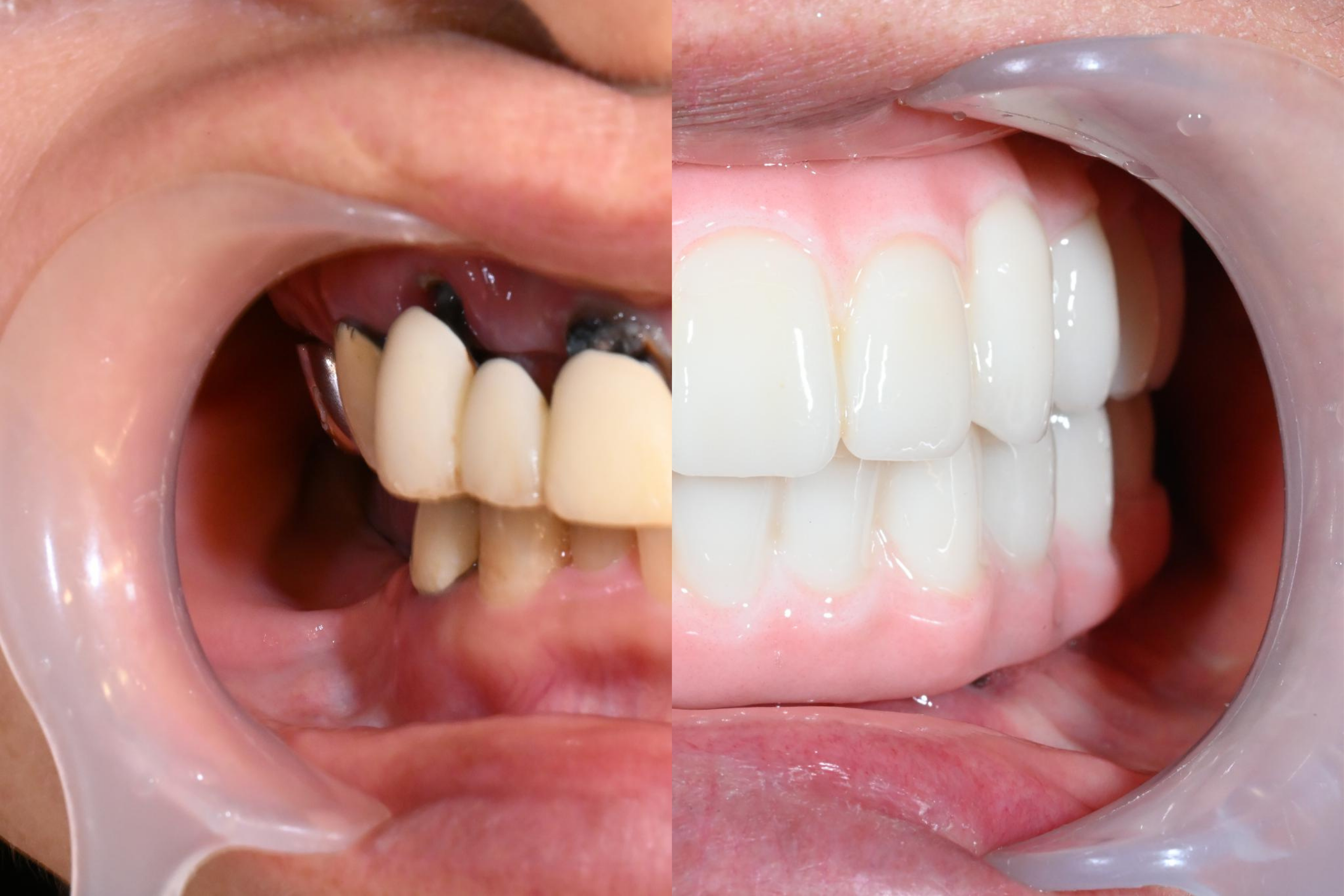 オールオン4ザイゴマ：松永瑠美子様