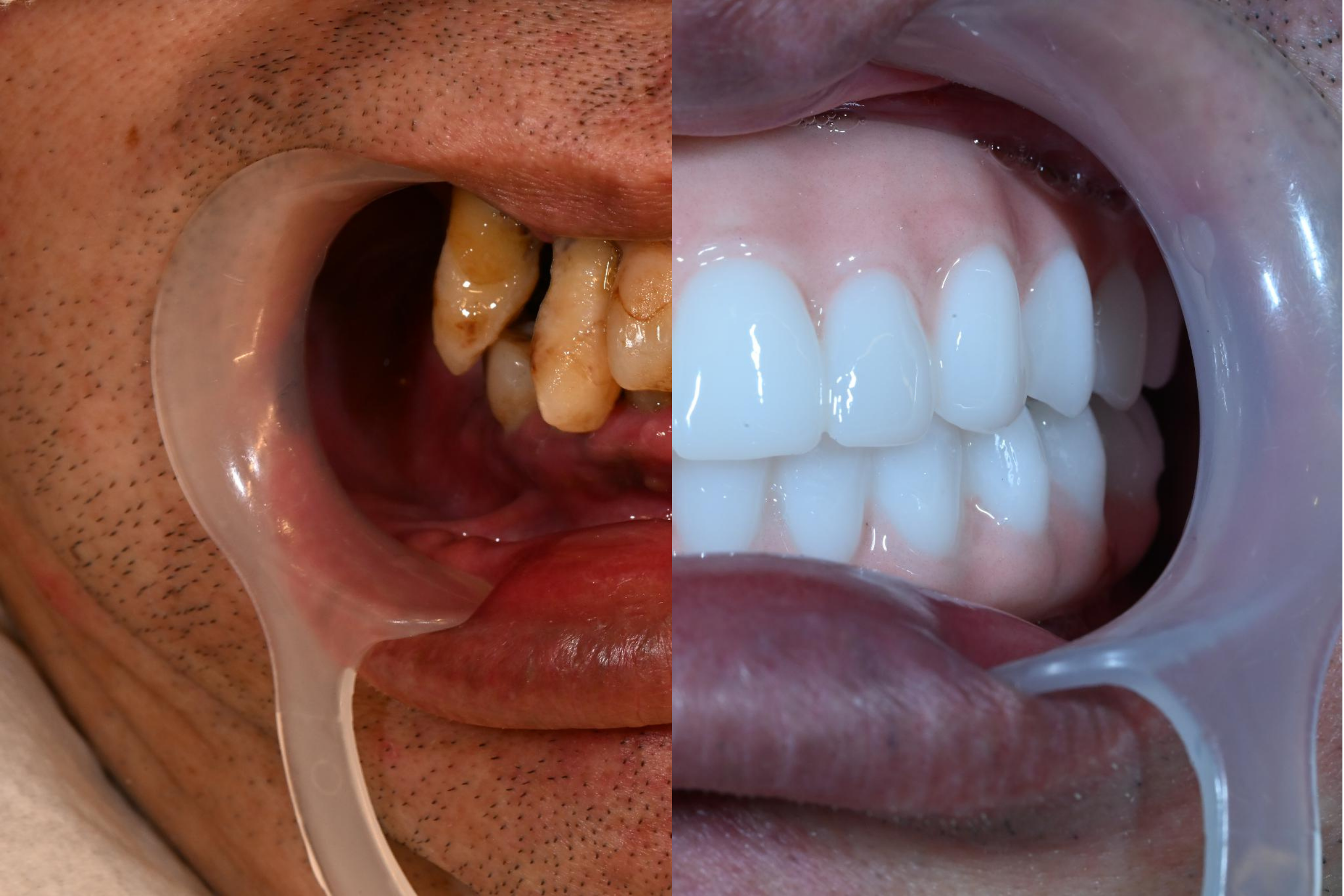 ザイゴマ2：岩佐真悟様