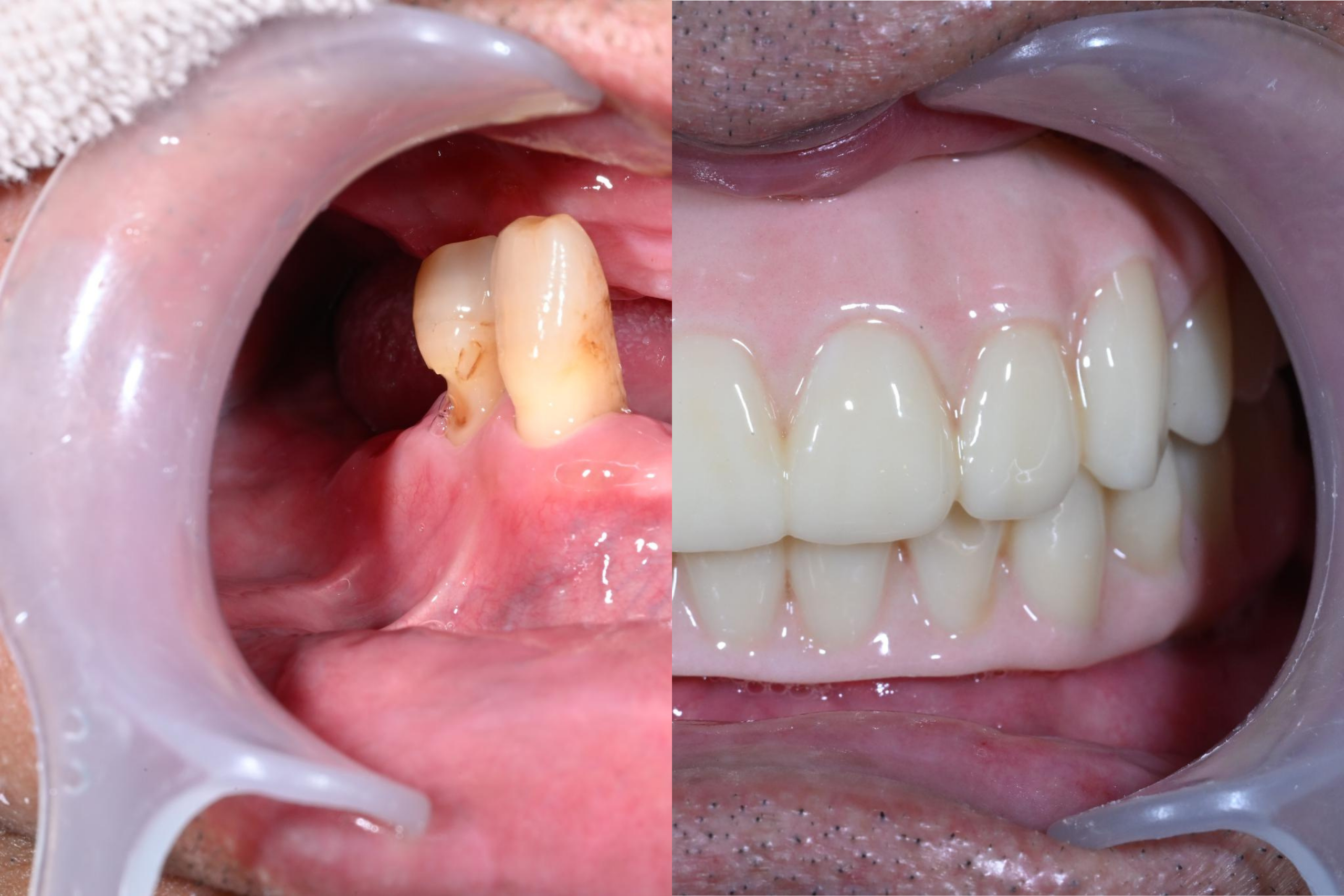 ノーマル：原晃一様