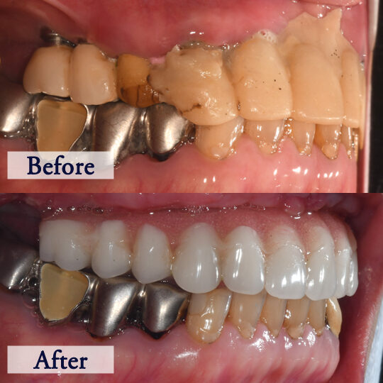 beforeafter_4