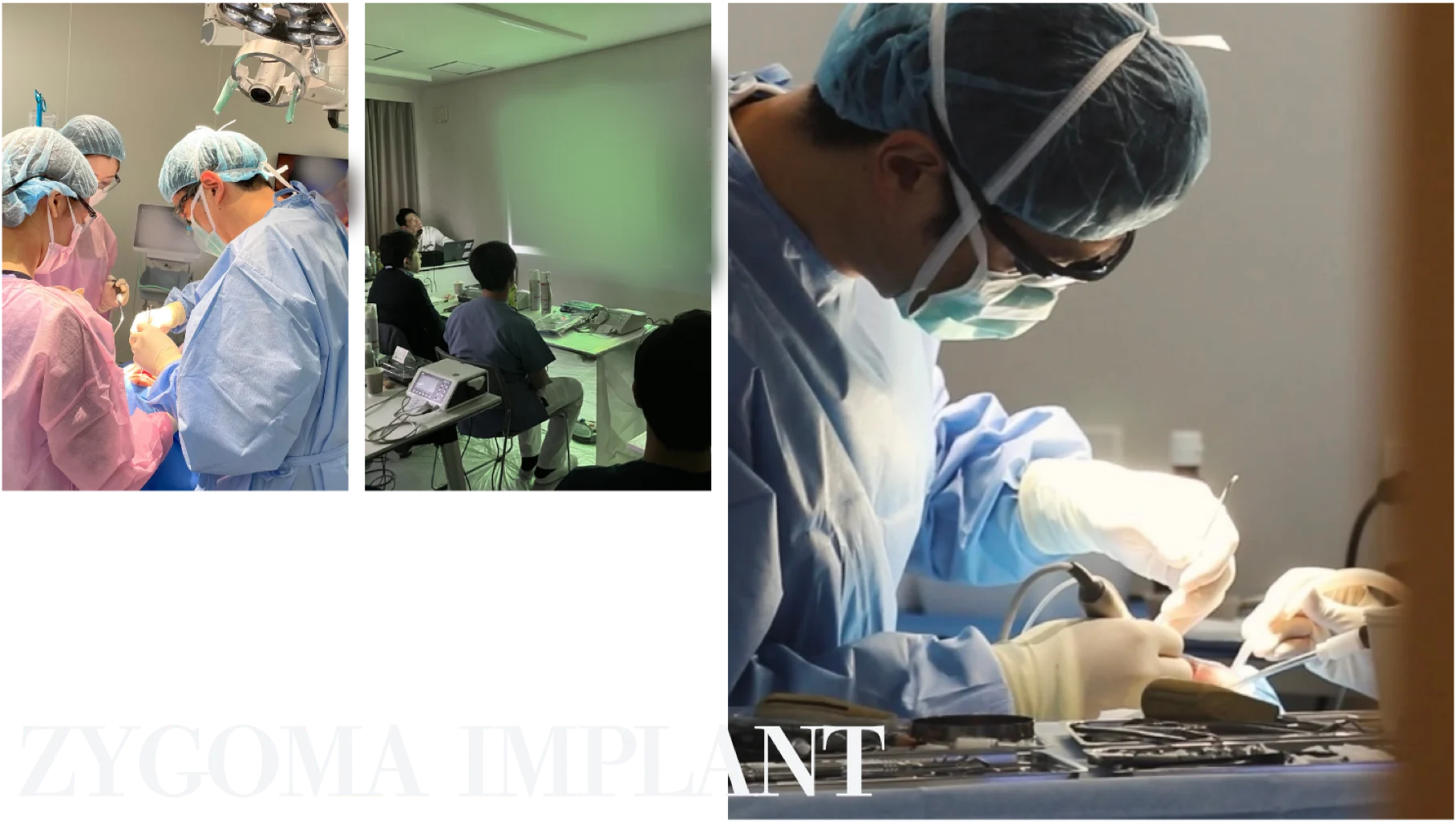 天才歯科医師と称されるナルト先生（大多和徳人院長）による高度なザイゴマインプラント手術