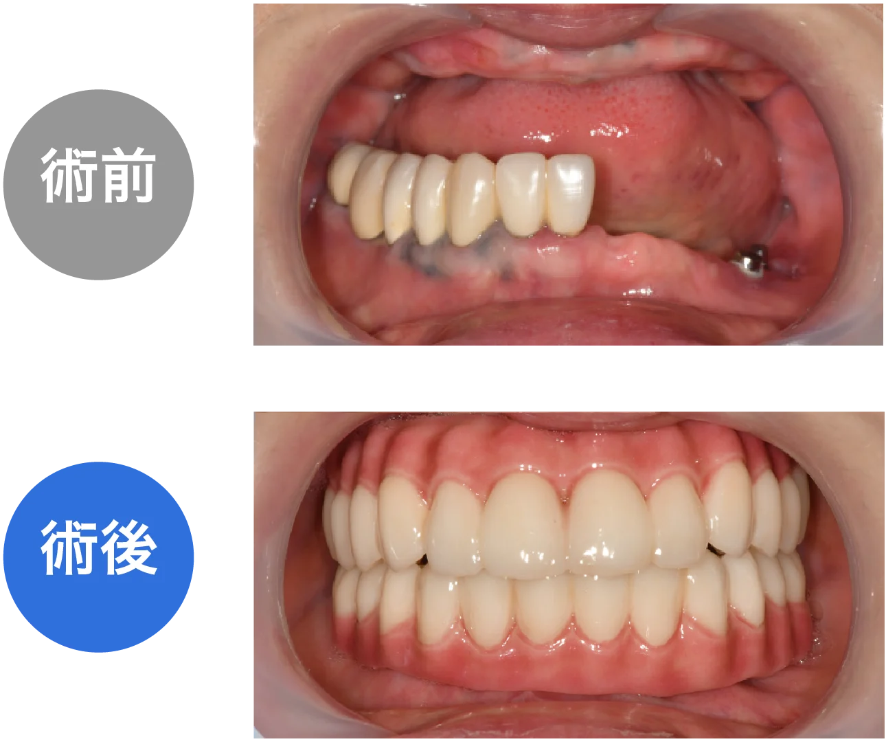 提案症例１