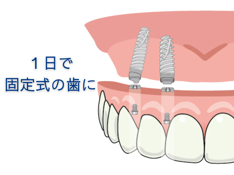 治療モニター (1)