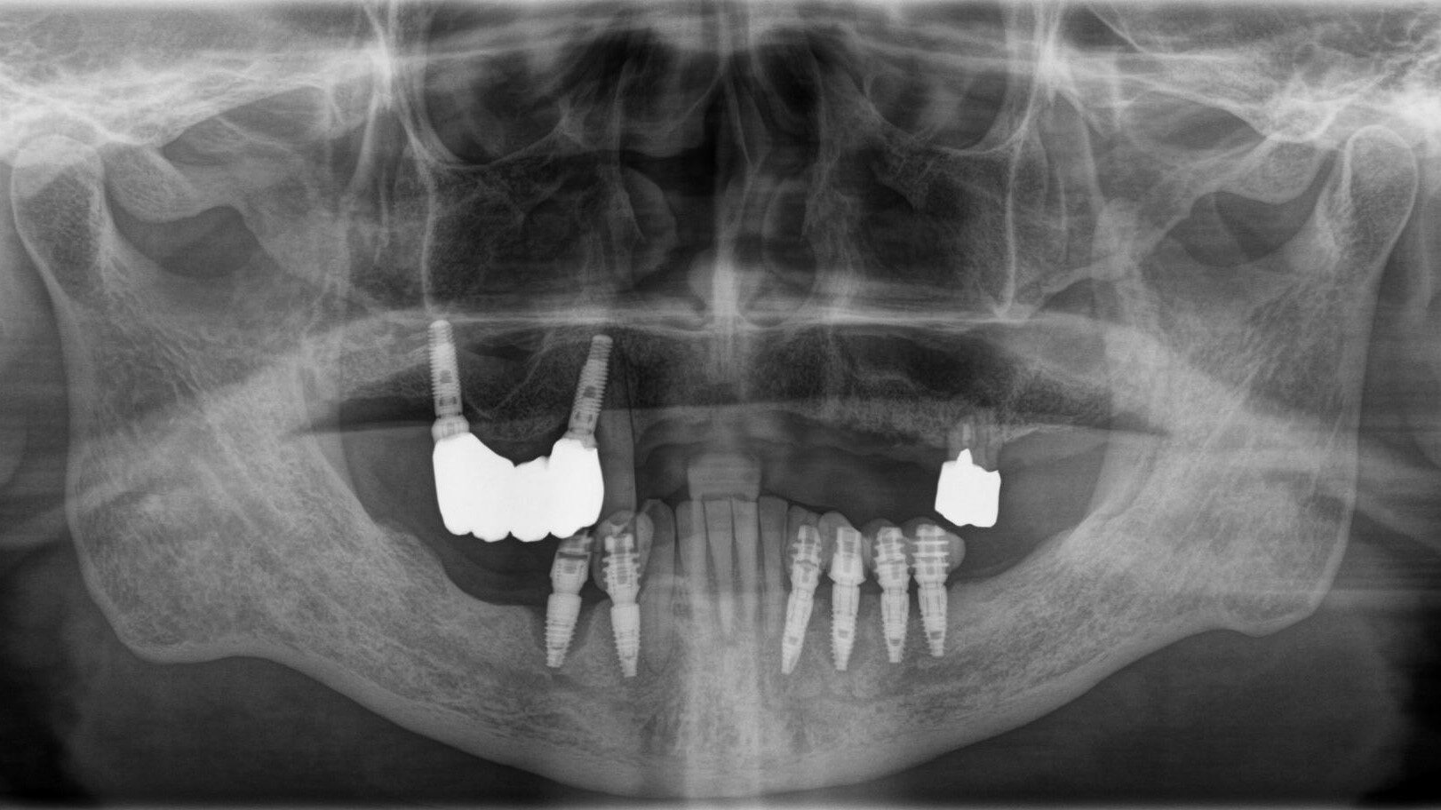 濵本_和年_ライトボックス(1)_P1_20230802_141944 (1)