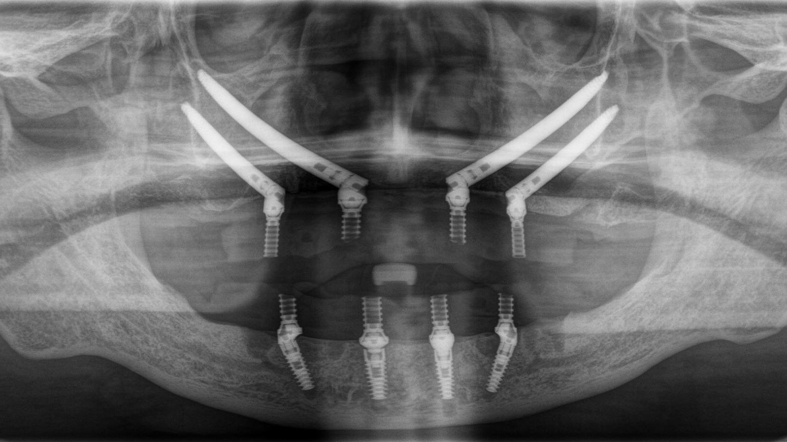 濵本_和年_ライトボックス(1)_P1_20231011_161336 (1)