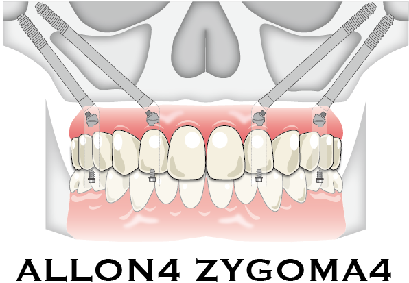 症例ボタン用-03