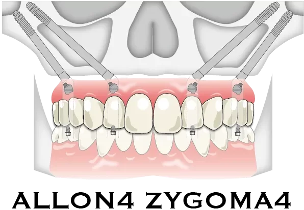 症例ボタン用-03