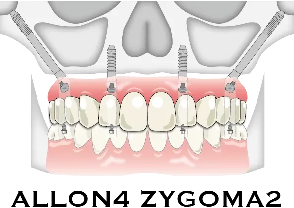 症例ボタン用-04