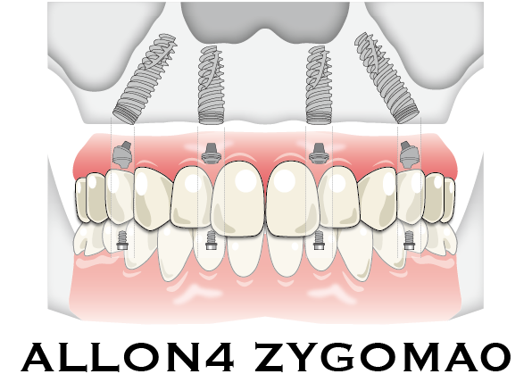 症例ボタン用-05