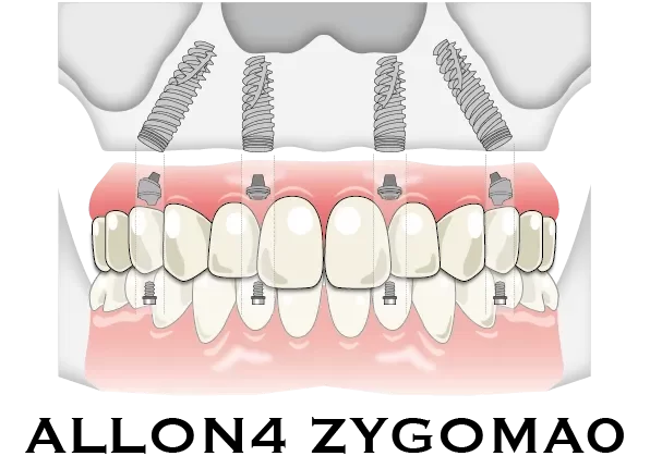 症例ボタン用-05